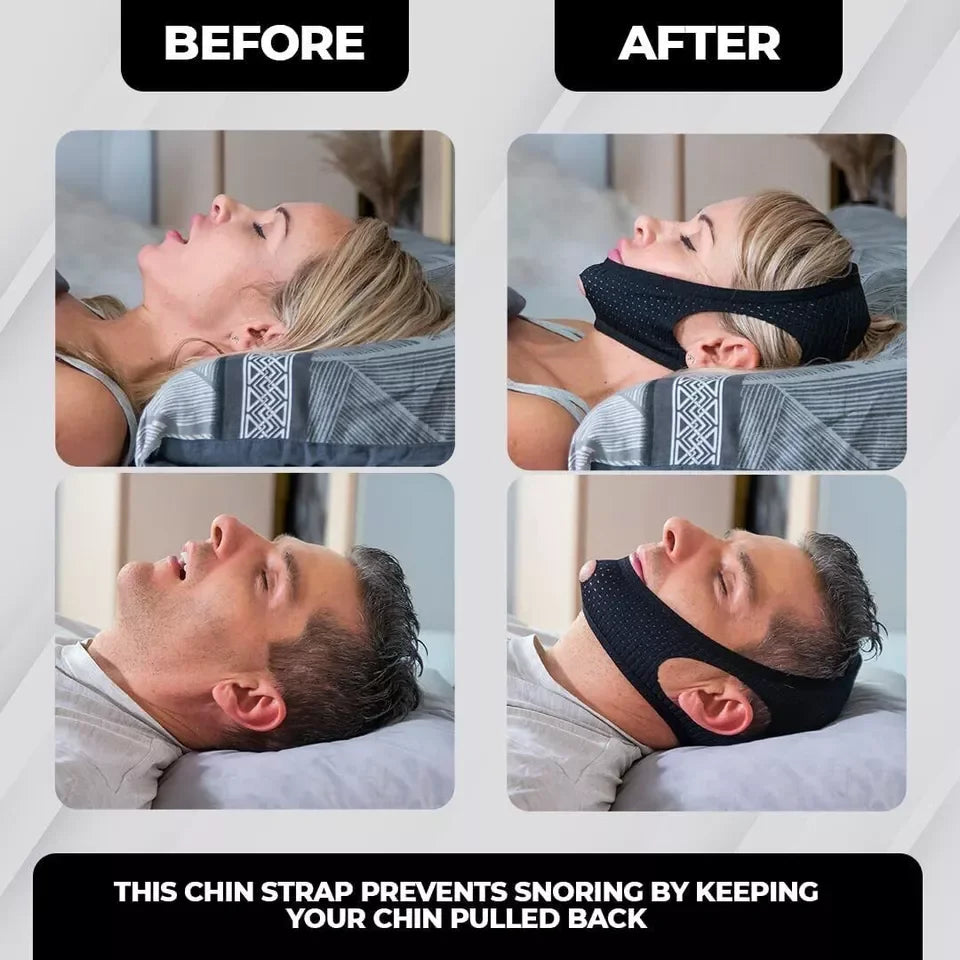 Mouth Guard Adjustable Anti-Snoring Strap Sleep Devices