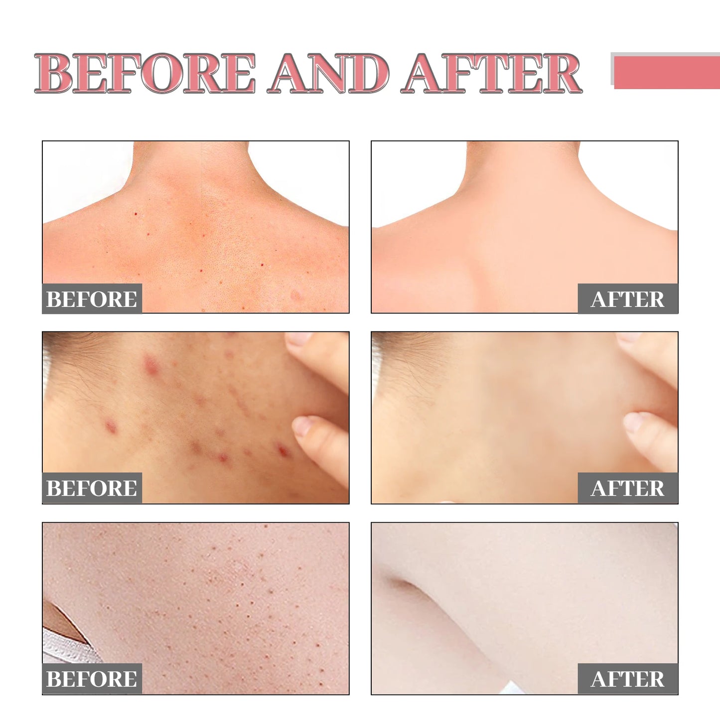 Jayusing Moisturizing Body Soap Deep Cleansing Remove Acne Cutin Skin Care Fragrance Shower Body Whitening Exfoliating Bath Soap