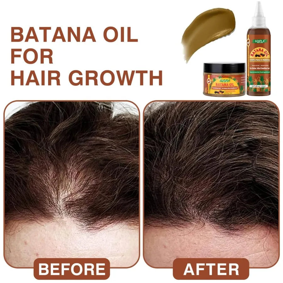 Hair Growth Serum Prevent Loss Repairs  Nourish
