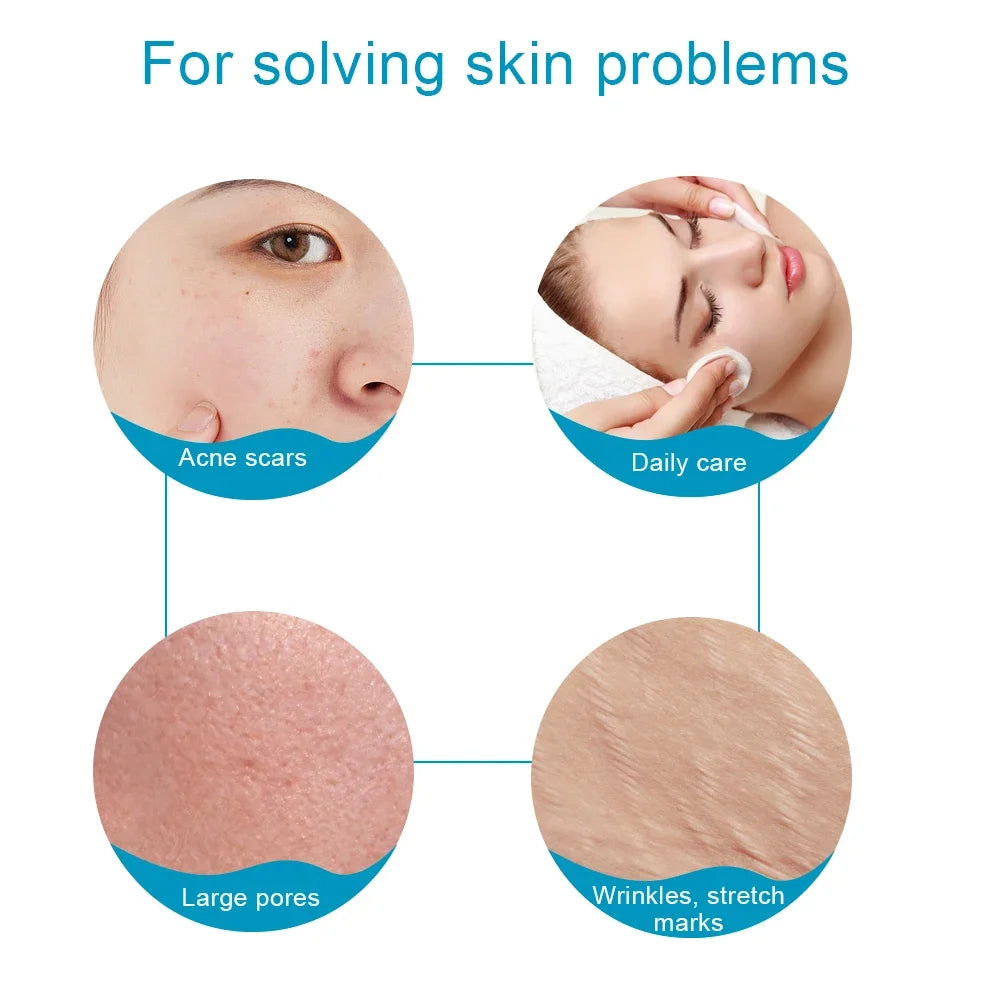 Titanium Derma Pen Roller Hair Growth Beard