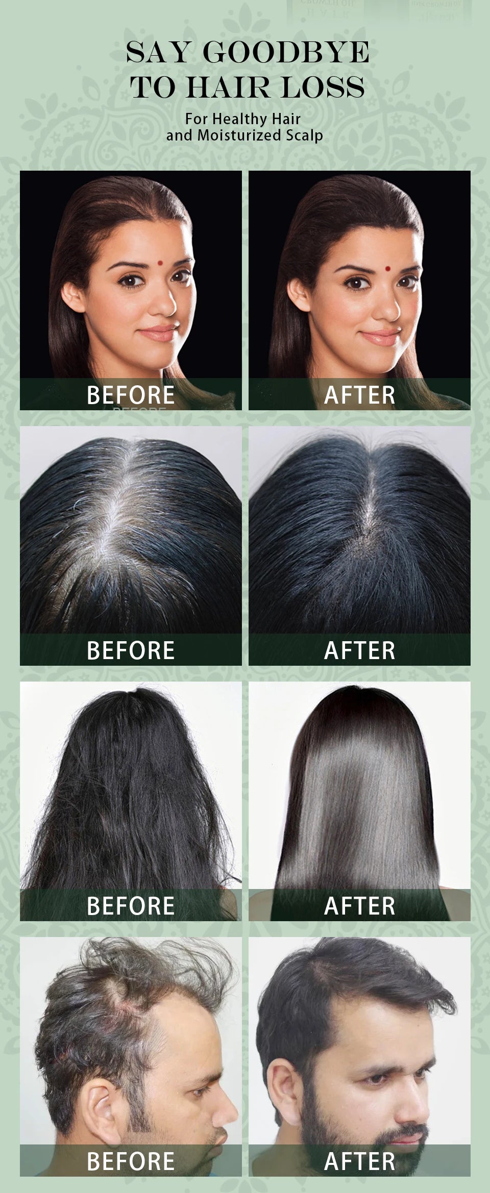 Ayurvedic Hair Growth Organic  Serum  Fast Regrowth