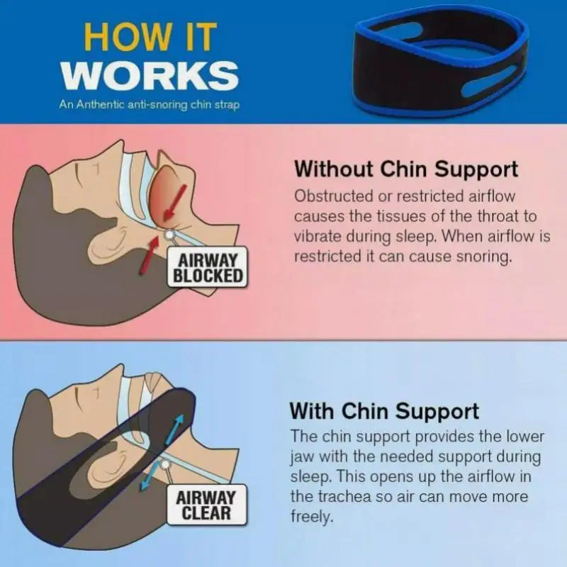 Anti-Snoring Chin Strap Mouth Guards  Breathe