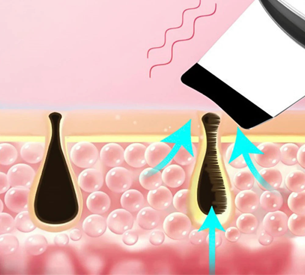 Scrubber Facial Pore Deep Cleanser Acne  Remover