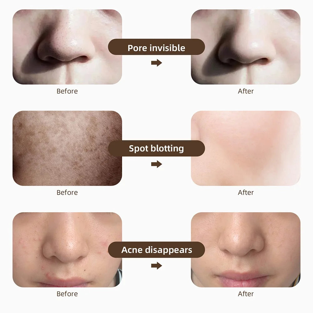 Wireless  Colors LED Face Neck Skin Rejuvenation