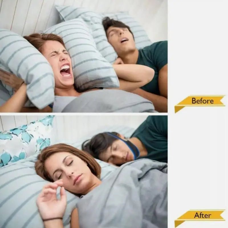 Anti-Snoring Chin Strap Mouth Guards  Breathe