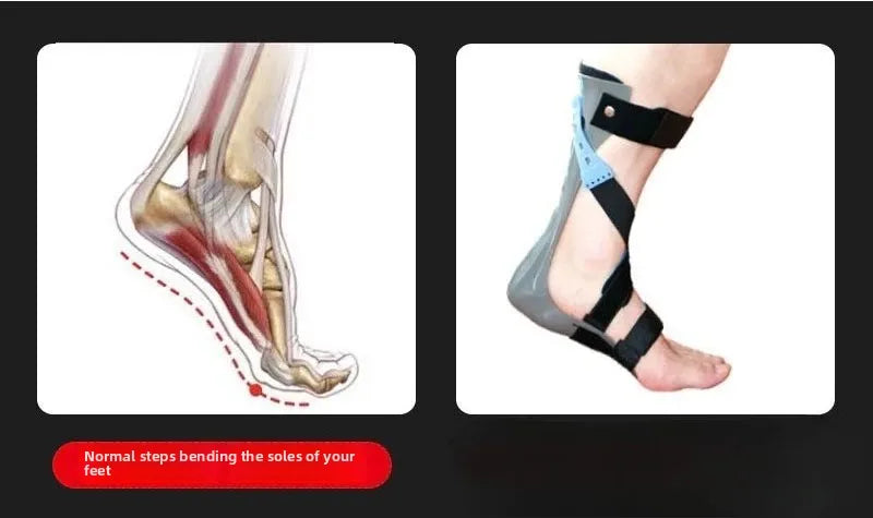 Adjustable Ankle-Foot Support Brace – Mobility Rehabilitation Aid for Drop Foot Alignment, Stability & Daily Comfort